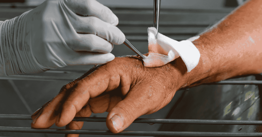 Wound Care Myths Debunked What You Really Need to Know Bellagio