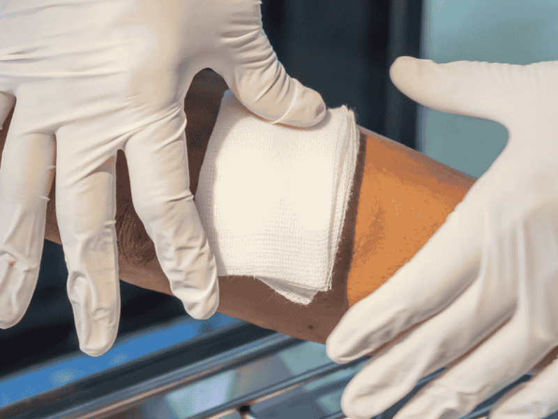 The Silent Threat: How Poor Circulation Delays Wound Healing