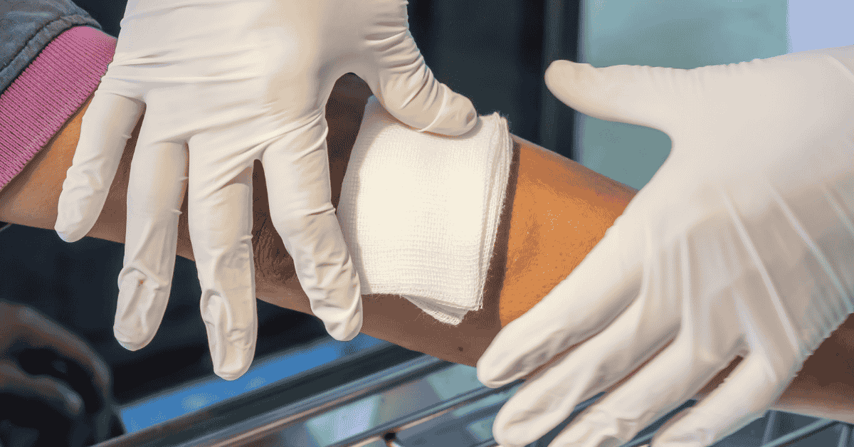 The Silent Threat: How Poor Circulation Delays Wound Healing
