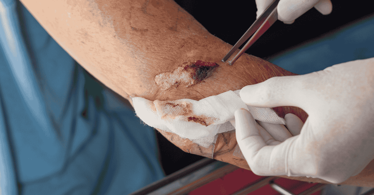 The Future of Wound Care: How Technology is Transforming Healing