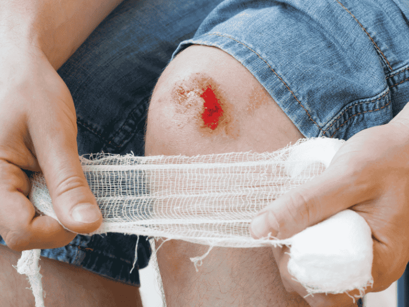 Home Care Tips for Managing Wounds Safely and Effectively