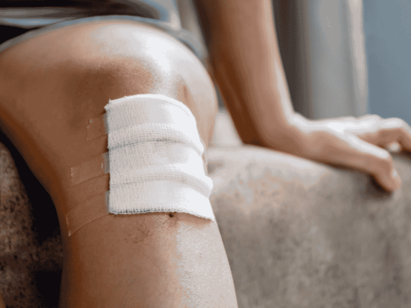Why Chronic Wounds Don’t Heal on Their Own — And When Specialized Wound Care Is Essential