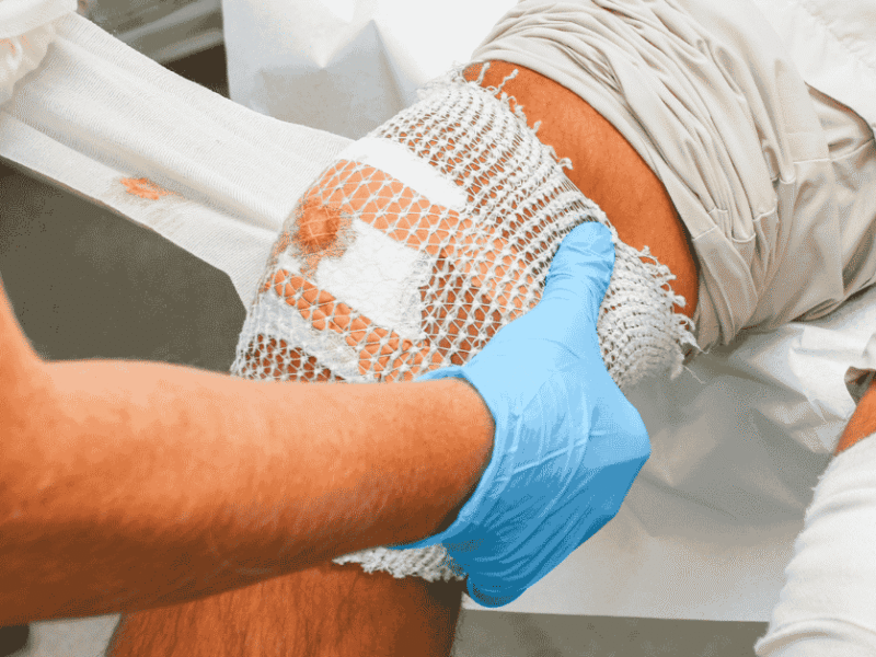 What Makes Advanced Wound Care Different from Traditional Treatment?