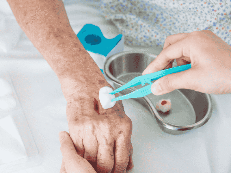 How Nutrition, Blood Flow, and Wound Care Work Together to Speed Healing