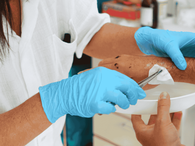 Surgical Wounds That Won’t Heal: When to See a Wound Care Specialist