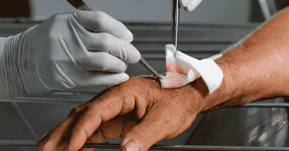 Advanced Wound Care Treatments That Help Wounds Heal Faster Advanced Wound Care Treatments That Help Wounds Heal Faster