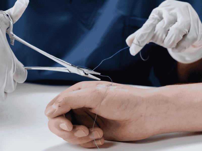 When Should You See a Wound Care Specialist?