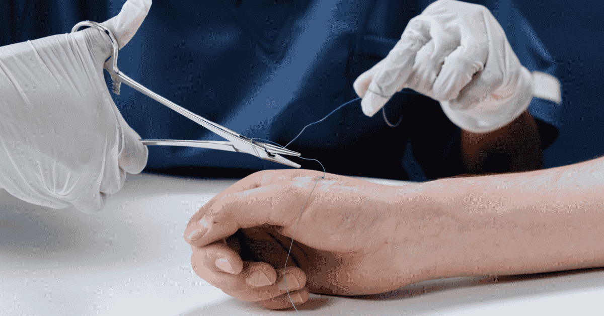 When Should You See a Wound Care Specialist? When Should You See a Wound Care Specialist?