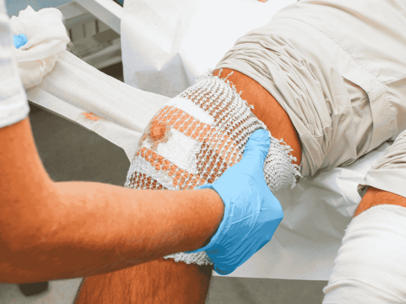 The Psychology of Chronic Wounds: Why Healing Is More Than Physical