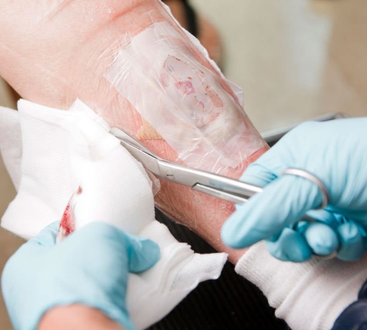 Wound Care Technology Expert Panel